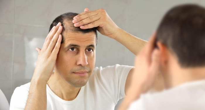 تساقط الشعر: أسبابه وعلاجاته 1 تساقط الشعر: أسبابه وعلاجاته 1