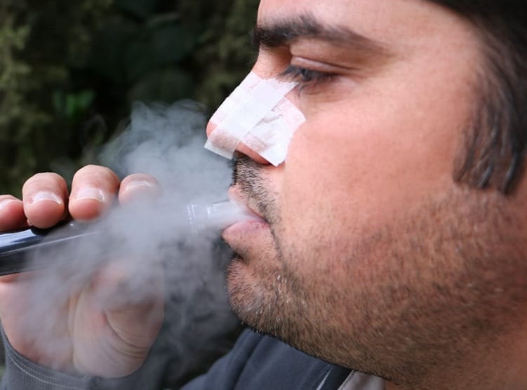 هل من المسموح أن أدخن بعد عملية تجميل الانف؟ 3 هل من المسموح أن أدخن بعد عملية تجميل الانف؟ 3