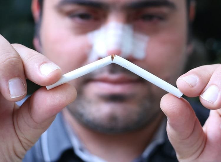 هل من المسموح أن أدخن بعد عملية تجميل الانف؟