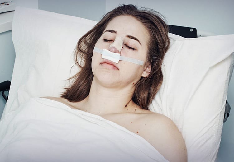 النوم بعد عملية تجميل الانف: ما هي وضعية النوم المناسبة؟ 1 النوم بعد عملية تجميل الانف: ما هي وضعية النوم المناسبة؟ 1