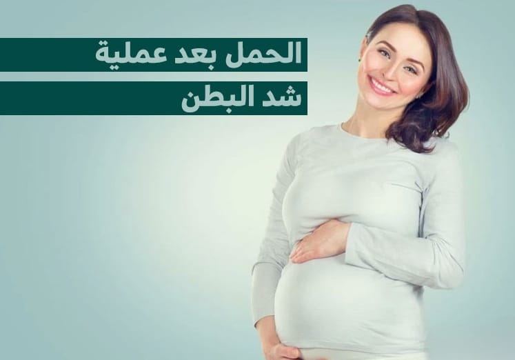 الحمل بعد شد البطن 1 الحمل بعد شد البطن 1
