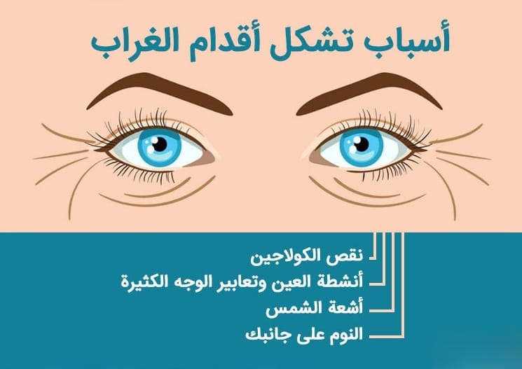 أفضل عمر لإجراء حقن البوتكس والفيلر 5 أفضل عمر لإجراء حقن البوتكس والفيلر 5