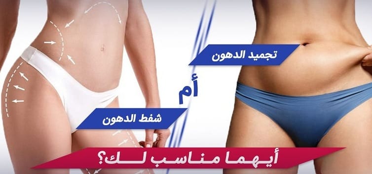 نحت الدهون أم شفط الدهون: أيهما الأفضل؟ 1 نحت الدهون أم شفط الدهون: أيهما الأفضل؟ 1