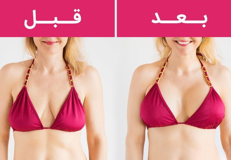 أفضل ماركات غرسات الثدي 6 أفضل ماركات غرسات الثدي 6