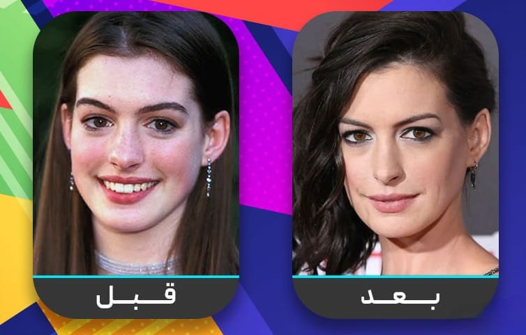 عشرون شخصية مشهورة اعترفت بإجراء عملية تجميل الأنف 4 عشرون شخصية مشهورة اعترفت بإجراء عملية تجميل الأنف 4