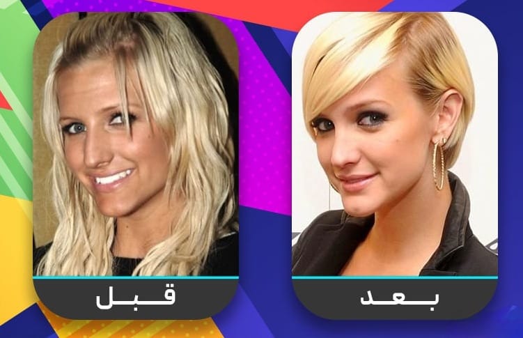 عشرون شخصية مشهورة اعترفت بإجراء عملية تجميل الأنف 12 عشرون شخصية مشهورة اعترفت بإجراء عملية تجميل الأنف 12