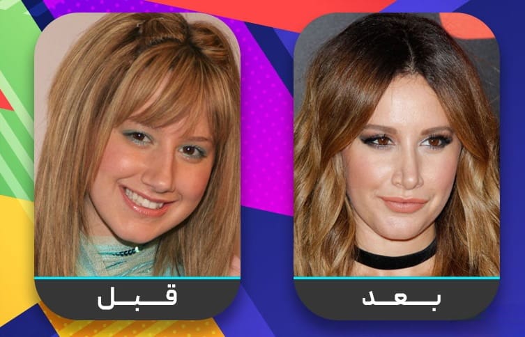 عشرون شخصية مشهورة اعترفت بإجراء عملية تجميل الأنف 10 عشرون شخصية مشهورة اعترفت بإجراء عملية تجميل الأنف 10