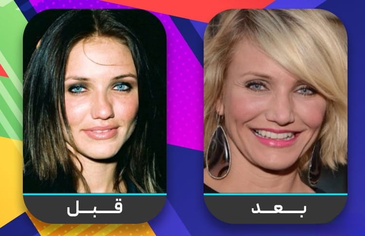 عشرون شخصية مشهورة اعترفت بإجراء عملية تجميل الأنف 5 عشرون شخصية مشهورة اعترفت بإجراء عملية تجميل الأنف 5