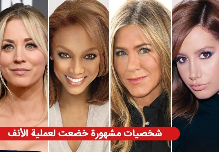 عشرون شخصية مشهورة اعترفت بإجراء عملية تجميل الأنف 1 عشرون شخصية مشهورة اعترفت بإجراء عملية تجميل الأنف 1