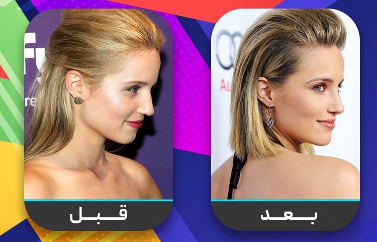 عشرون شخصية مشهورة اعترفت بإجراء عملية تجميل الأنف 11 عشرون شخصية مشهورة اعترفت بإجراء عملية تجميل الأنف 11