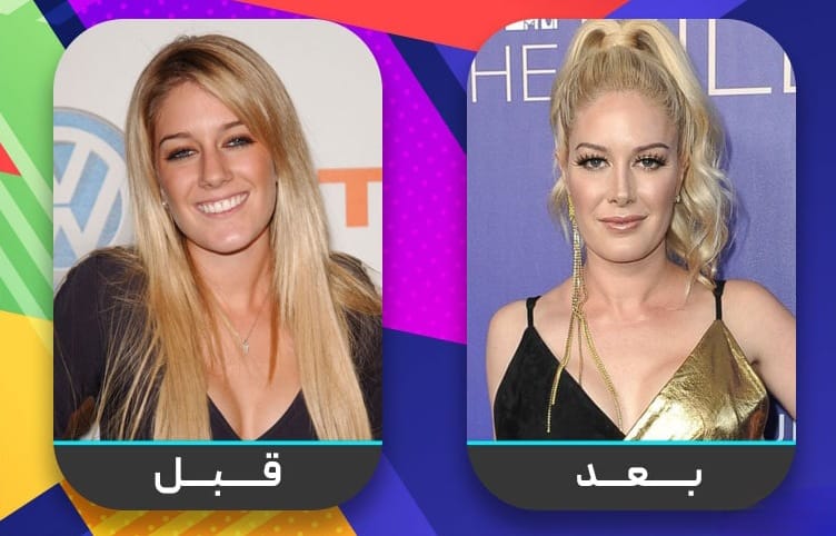 عشرون شخصية مشهورة اعترفت بإجراء عملية تجميل الأنف 19 عشرون شخصية مشهورة اعترفت بإجراء عملية تجميل الأنف 19