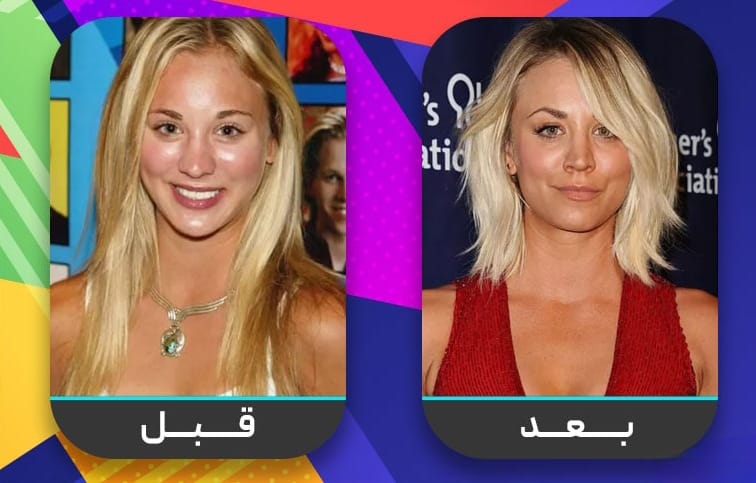 عشرون شخصية مشهورة اعترفت بإجراء عملية تجميل الأنف 3 عشرون شخصية مشهورة اعترفت بإجراء عملية تجميل الأنف 3