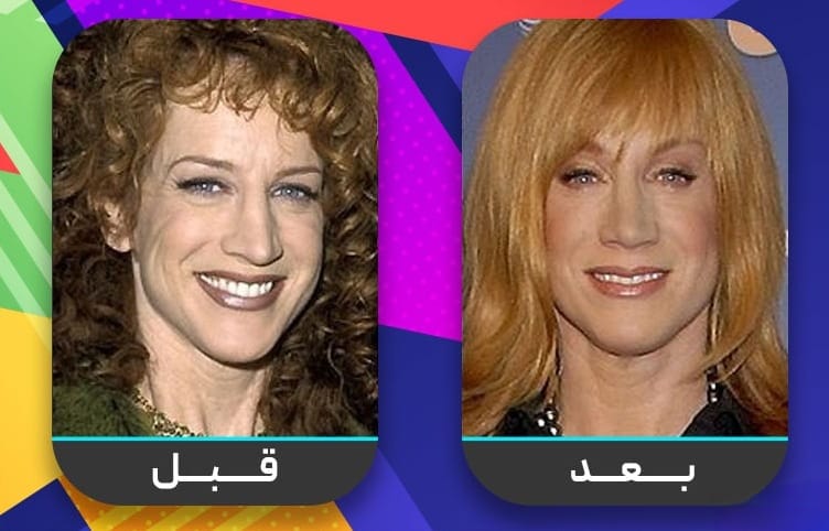 عشرون شخصية مشهورة اعترفت بإجراء عملية تجميل الأنف 18 عشرون شخصية مشهورة اعترفت بإجراء عملية تجميل الأنف 18