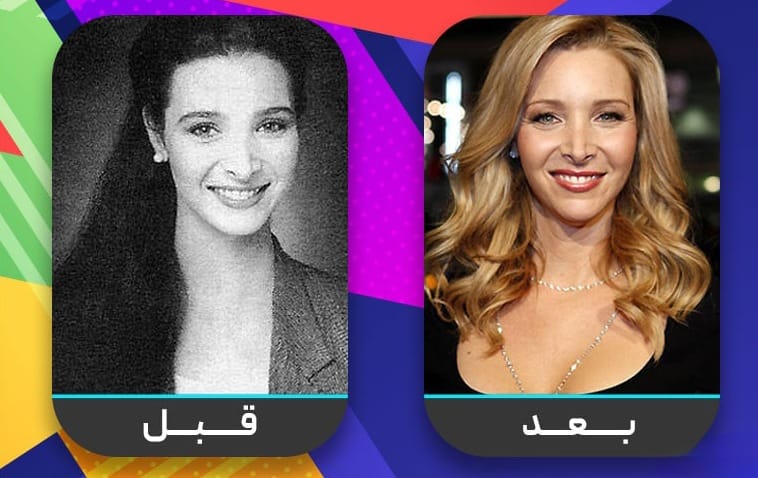 عشرون شخصية مشهورة اعترفت بإجراء عملية تجميل الأنف 6 عشرون شخصية مشهورة اعترفت بإجراء عملية تجميل الأنف 6