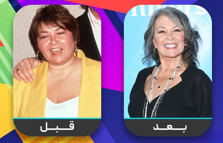 عشرون شخصية مشهورة اعترفت بإجراء عملية تجميل الأنف 15 عشرون شخصية مشهورة اعترفت بإجراء عملية تجميل الأنف 15