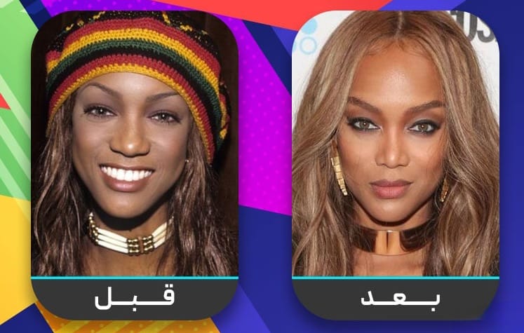 عشرون شخصية مشهورة اعترفت بإجراء عملية تجميل الأنف 8 عشرون شخصية مشهورة اعترفت بإجراء عملية تجميل الأنف 8