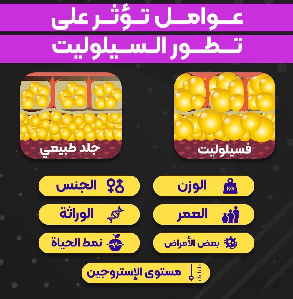 6 علاجات فعالة للتخلص من السيلوليت 2 6 علاجات فعالة للتخلص من السيلوليت 2