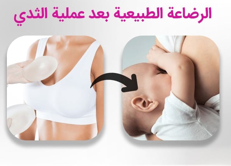 هل تؤثر عملية الثدي على الرضاعة الطبيعية؟ 1 هل تؤثر عملية الثدي على الرضاعة الطبيعية؟ 1