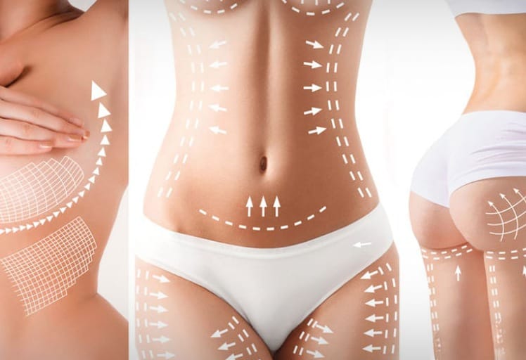 دليل عمليات التجميل قبل الزفاف: اظهري بأفضل مظهر في يومك الكبير 3 دليل عمليات التجميل قبل الزفاف: اظهري بأفضل مظهر في يومك الكبير 3
