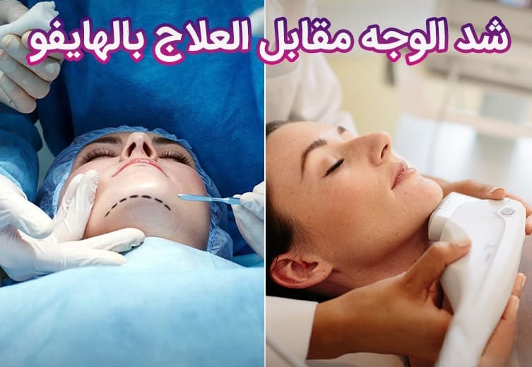 عملية شد الوجه مقابل العلاج بالهايفو: الخيار المناسب لك لمكافحة الشيخوخة 1 عملية شد الوجه مقابل العلاج بالهايفو: الخيار المناسب لك لمكافحة الشيخوخة 1