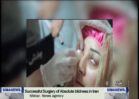 العلاج الناجح للعمى التام في إيران 2 العلاج الناجح للعمى التام في إيران 2